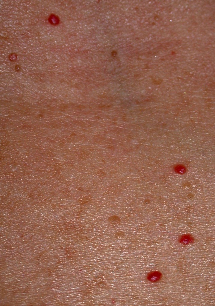 pinpoint red spots on skin not itchy