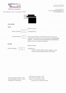 My Iodine Loading Test Results